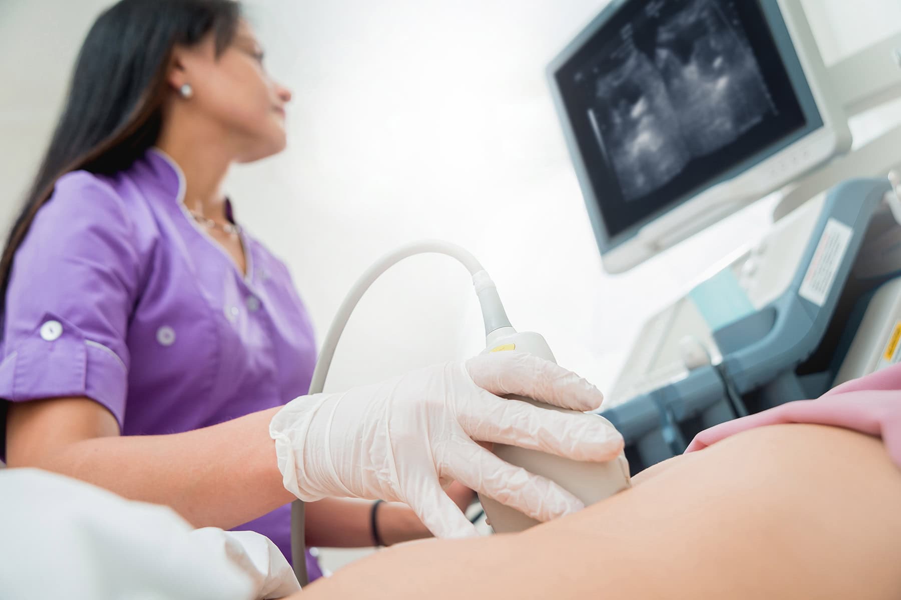 Misdiagnosed Ectopic Pregnancy 